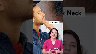 Acanthosis Nigricans Treatment  Reason of Black Neck  How to Treat Black Neck  Dr Sridevi [upl. by Yrogerg]