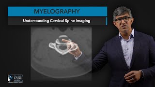 What is Myelography​ of the Cervical Spine [upl. by Bevin651]