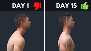 SUPER SIMPLE amp Effective Fix For Rounded Shoulders amp Forward Head Posture [upl. by Nevuer317]