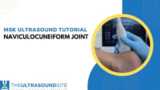 Naviculocuneiform joint NCJ [upl. by Tolman]