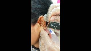 earloberepairhow to repair ear lobe 👂 [upl. by Enilarac645]