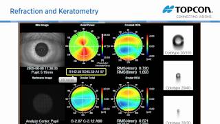 Topcon KR 1W wavefront amp topography system [upl. by Ahsimit]