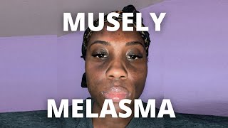 Musely Spot Cream for Melasma Day 1 [upl. by Llyrat]