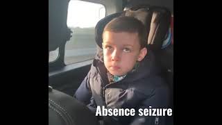 absence seizurepetit mal seizure [upl. by Kirchner]