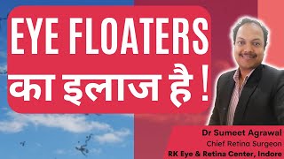 EYE FLOATERS का इलाज है  DO NOT LOSE HOPE  EYE FLOATERS को हटाया जा सकता है [upl. by Vivie]