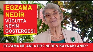 EGZAMA NE ANLATIR NEDEN KAYNAKLANIR quotEGZAMADAN BÄ°R TÃœRLÃœ KURTULAMIYORUMquot DÄ°YENLER MUTLAKA Ä°ZLEYÄ°N [upl. by Niriam]