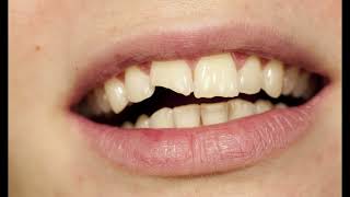 Why Cant Teeth Regrow  The Surprising Science Explained [upl. by Shriner]