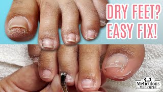 Step by Step Pedicure Tutorial on Dry Feet [upl. by Ruby]