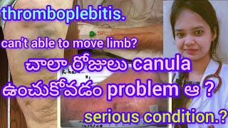 చాలా రోజులు canula ఉంచుకోవడం problem ఆ  thromboplebitisserious conditioncant able to move limb [upl. by Winshell624]