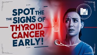 Thyroid Cancer Symptoms amp Early Warning Signs  Hypothyroidism  Thyroid  Cancer [upl. by Aryl]