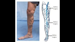 How to REVERSE AGING CLEAN YOUR VEINS ARTERIES BLOOD in legs and all your BODY with JUST 1 HERB [upl. by Lejeune925]