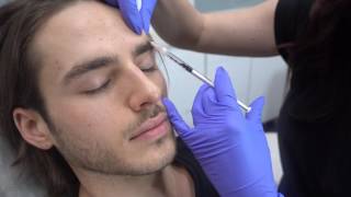 Preventative Glabella Dysport on Male Client [upl. by Obeng]