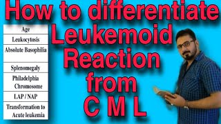 How to differentiate Leukemoid Reaction from Chronic Myeloid Leukemia [upl. by Learsiy470]