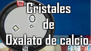 Cristales de oxalato de calcio normales y monohidratado Uroanalisis [upl. by Gerge]