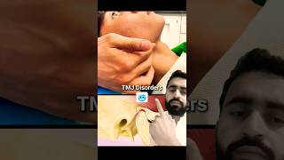 Temporomandibular joint disorder tmjtmjdisorder dentist dental [upl. by Nappie]