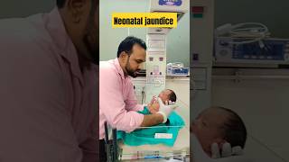 Neonatal jaundice  nicu jaundice jaundicetreatment newborn [upl. by Gnoht]