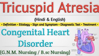 Tricuspid Atresia  Tricuspid Atresia In Hindi  Congenital Heart Disease [upl. by Euqinamod]