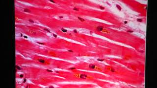 Cardiac Muscle Tissue [upl. by Latsyc753]