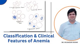 Classification amp Clinical Features of Anemia  Blood Physiology  RBCs [upl. by Edmee543]