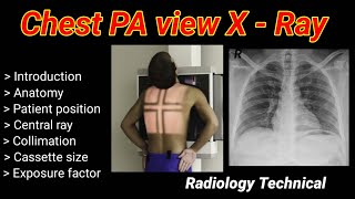 Chest PA View XRay  Posterior to Anterior view  part 1   By BL Kumawat [upl. by Aneetsirhc]