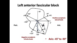 ECG course Fascicular Blocks Dr Sherif Altoukhy [upl. by Flann90]