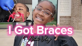 I got braces at 8 years old to fix my crossbite  Orthodontic Treatment [upl. by Holms94]