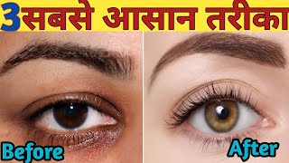 डार्क सर्कल्स हटाने के तीन अचूक उपाय  Dark Circles Remove Eyes Pack Kitchen Tips  Home Tips [upl. by Casaleggio68]