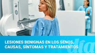 Lesiones benignas en los senos causas síntomas y tratamientos [upl. by Tray]