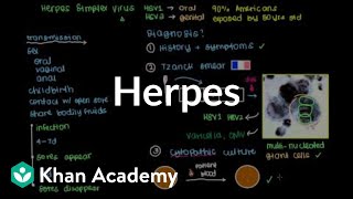 Diagnosis treatment and prevention of herpes  Infectious diseases  NCLEXRN  Khan Academy [upl. by Felicia]