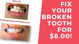 How I fixed my broken tooth for 8 Dollars [upl. by Aicelaf]