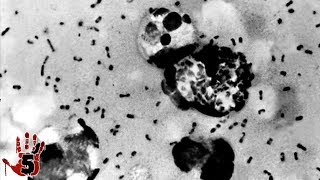 Top 5 Scariest Viruses On Earth Today [upl. by Maroney]