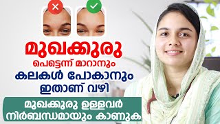 മുഖക്കുരു Acne Pimples പെട്ടെന്ന് മാറാനും കലകൾ പോകാനും ഇതാണ് വഴി [upl. by Annav291]