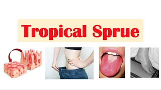 Tropical Sprue  Causes Pathogenesis Signs amp Symptoms Diagnosis Treatment [upl. by Monsour50]