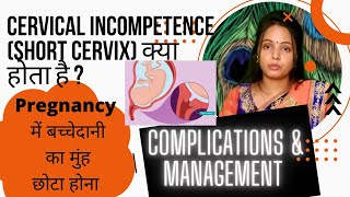 What is Cervical incompetence  Short cervix  Treatment complications amp management [upl. by Airreis]