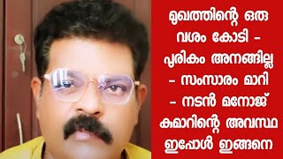 തനിക്ക് സംഭവിച്ചത് പറഞ്ഞ് നടൻ  ആശ്വാസവാക്കുകളുമായി ആരാധകർ  Manoj Kumar [upl. by Ymrej487]