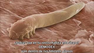 DEMODEX un ácaro que vive en tu rostro Atomy lo elimina [upl. by Carlyle68]