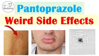 Pantoprazole Weird Side Effects Skin Infections Nutrient Deficiencies amp Why They Occur [upl. by Ellierim]