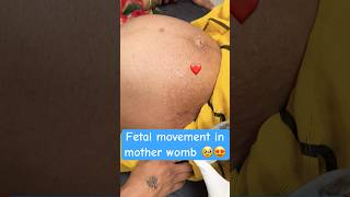 fetal movement in mother wombpregnancy periodviral [upl. by Egiarc950]