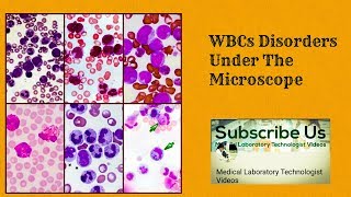 WBC Disorders Under The Microscope [upl. by Hachmin]