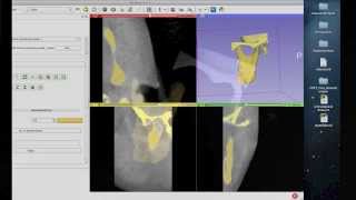 Tutorial Preparing Data for 3D Printing Using 3D Slicer [upl. by Cart812]