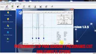 ECG CONTEC USO DE PROGRAMA [upl. by Alyce]