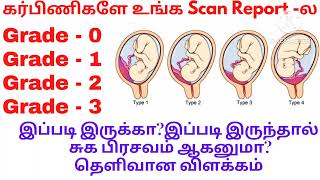 Placenta Grade 0placenta Grade 1 Grade 2Grade 3 என்றால் என்னPlacenta maturity grading in tamil [upl. by Adnelg175]