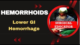 HEMORRHOIDS How To DIAGNOSE amp TREAT Lower GI Hemorrhage [upl. by Gnurt]