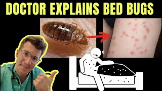 Doctor explains BED BUGS  including SYMPTOMS TREATMENT AND PREVENTION  PHOTOS [upl. by Nodnerb346]