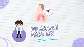 Pulmonary embolism Pathophysiology Types diagnosis amp Treatment [upl. by Nathanoj]