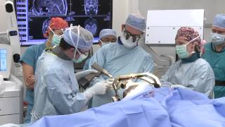 What Happens During a Laser Ablation Surgery for Epilepsy [upl. by Brendis]