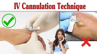 Intravenous Cannulation Technique  IV Cannula Procedure [upl. by Lleuqram]