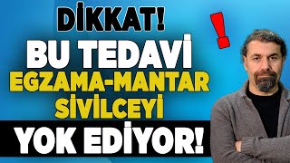 SİVİLCELERE KALICI ÇÖZÜM  Egzama  Mantar  Sivilce Hastalıklarının TEDAVİ YOLU  Dr Hamit Çelik [upl. by Ivanna186]