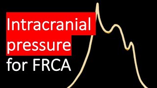 Intracranial pressure ICP explained waveforms and methods [upl. by Akcimahs]