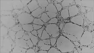 tube formation huvec [upl. by Annodahs80]